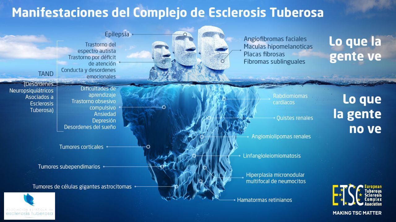 Asociación Española de Esclerosis Tuberosa: Atención a afectados y familias