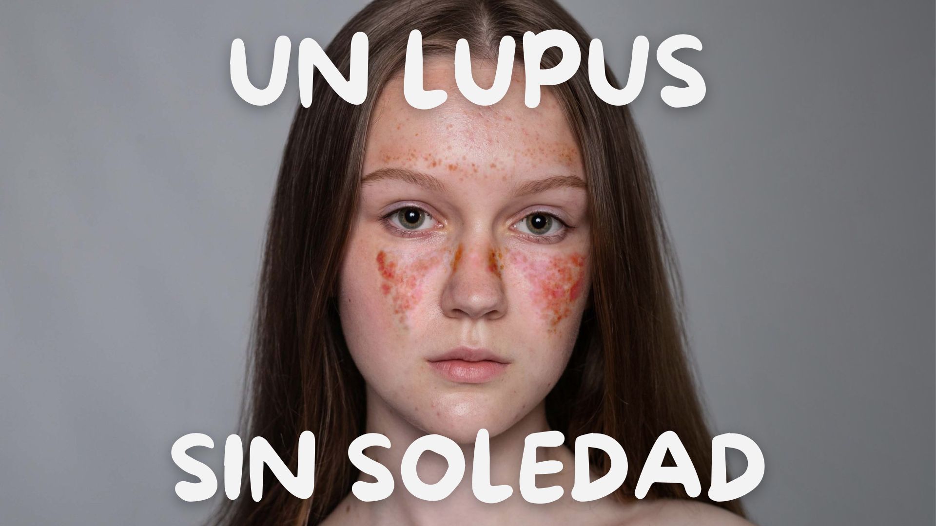 Asociación Galega de Lupus (AGAL)