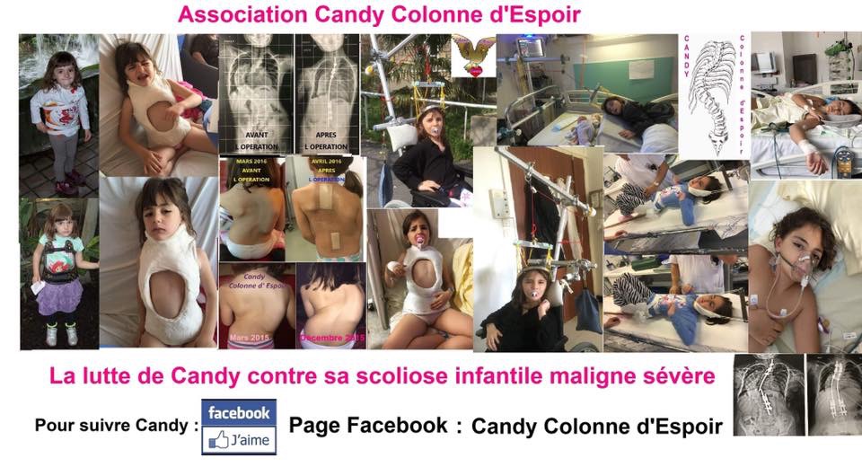 Candy Colonne d’Espoir